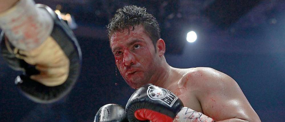 Blutige Angelegenheit. Boxer Manuel Charr war schon während seines Kampfes gegen Witali Klitschko böse gezeichnet.