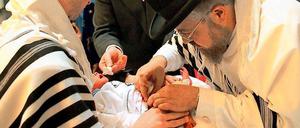 Eine rituelle Beschneidung. Der Streit darum ebbt nicht ab.