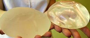 Betroffenen wird geraten Implantate der Firma PIP entfernen zu lassen.