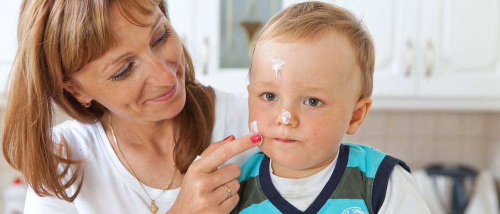 „Zeigt die Haut Zeichen von Trockenheit, cremt!“, rät der Kinderdok.