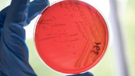 Im Visier der Mikrobenfahnder. Mikrobiologen und Seuchenexperten versuchen zu klären, woher der EHEC-Erreger stammt. Eine exakte „Typenbestimmung“ des Bakteriums im Labor ermöglicht die genaue Zuordnung zur Quelle des Keims - falls diese gefunden werden sollte. 