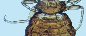 Kleiner Quälgeist. Mikroskopische Aufnahme einer Elefantenlaus. Foto: dpa