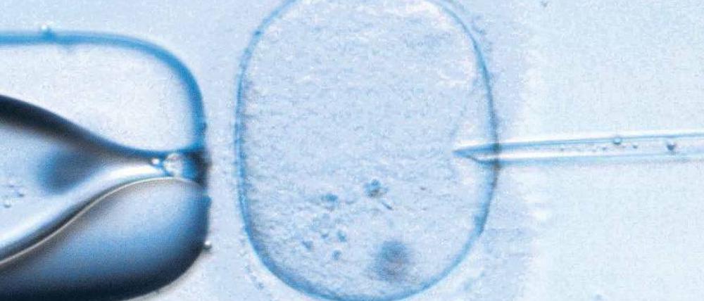 Künstliche Befruchtung. Foto: dpa