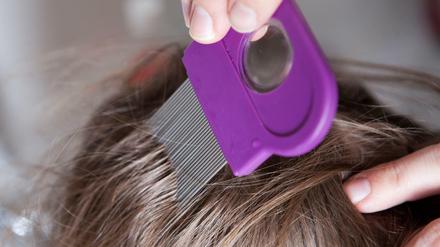 Die Suche nach Läusen zu durchsuchen, hat im nassen Haar mehr Sinn. Dort sieht man mögliche Krabbler und die Nissen besser.