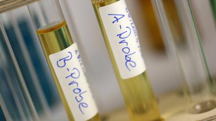 Vorstoß gegen Doping: Das Gesetz soll schnellstmöglich verabschiedet werden.