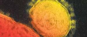 Gefährlich. Das Coronavirus Mers dringt in verschiedene Zellarten tief in der Lunge ein. So verursacht es bei den Patienten schwere Entzündungen und akute Atemnot. 