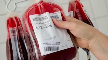 Wirkt junges Blut wie ein Jungbrunnen? Und wie geht das genau? Auf diese Fragen haben Forscher noch keine Antworten