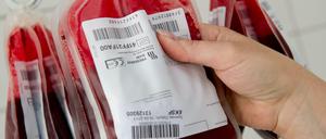 Wirkt junges Blut wie ein Jungbrunnen? Und wie geht das genau? Auf diese Fragen haben Forscher noch keine Antworten