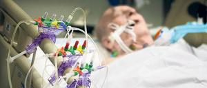 Schmaler Grat. Für hoch betagte oder aussichtslos Kranke ist die Hochleistungsmedizin oft eher eine leidvolle Sterbeverzögerung als sinnvolle Lebensverlängerung.