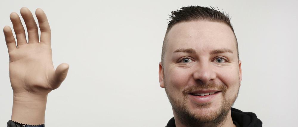 Milorad Marinkovic ist einer von drei Patienten, denen an der Medizinischen Universität Wien eine "bionische" Hand angepasst wurde, die er mit Hilfe seiner eigenen Gedanken steuern kann.