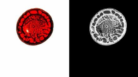 Blutbild. Der Fotograf Kilian Foerster hat menschliches Blut abgelichtet und dann Bild und Negativ nebeneinander präsentiert. In seiner Arbeit setzt er sich häufig mit der Stigmatisierung HIV-positiver Menschen auseinander. 