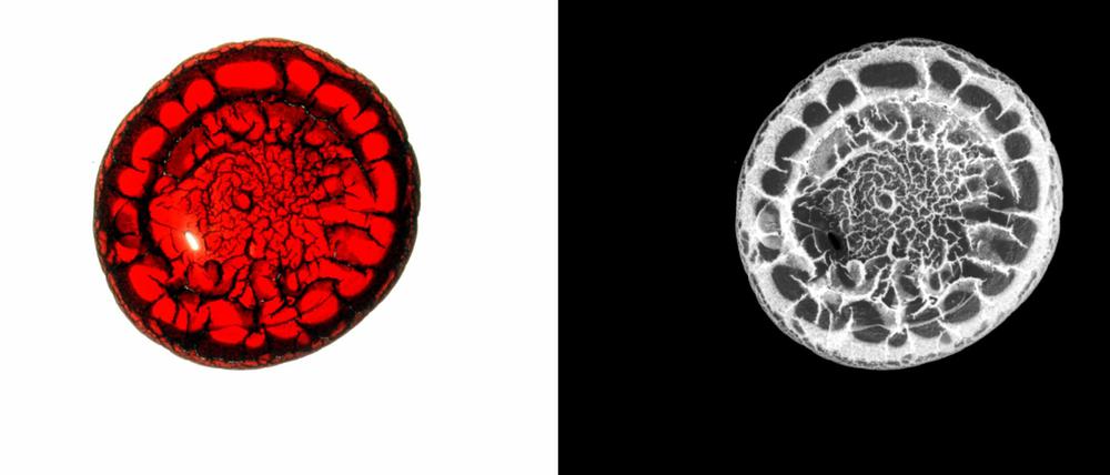 Blutbild. Der Fotograf Kilian Foerster hat menschliches Blut abgelichtet und dann Bild und Negativ nebeneinander präsentiert. In seiner Arbeit setzt er sich häufig mit der Stigmatisierung HIV-positiver Menschen auseinander.