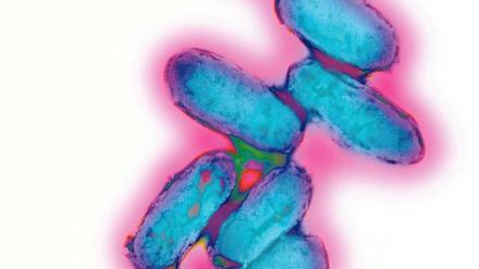 Ein Bakterium, das die Menschheit seit Jahrtausenden heimsucht: Yersinia pestis, der Pest-Erreger.
