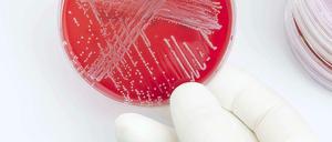 Ungesundes Wachstum: Nachweis von Bakterien in der Petrischale.