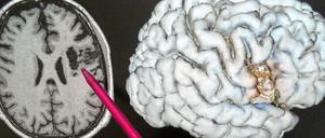 Aufnahme eines Gehirns.