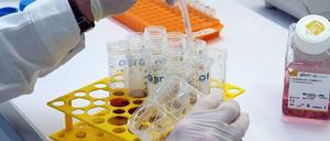 Umstritten. Die Forschung mit embryonalen Stammzellen ist in der EU streng geregelt.