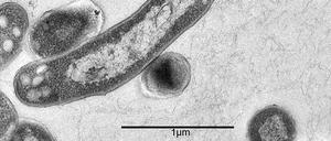 Widerspenstig. Mycobacterium tuberculosis, aufgenommen unter dem Elektronenmikroskop.