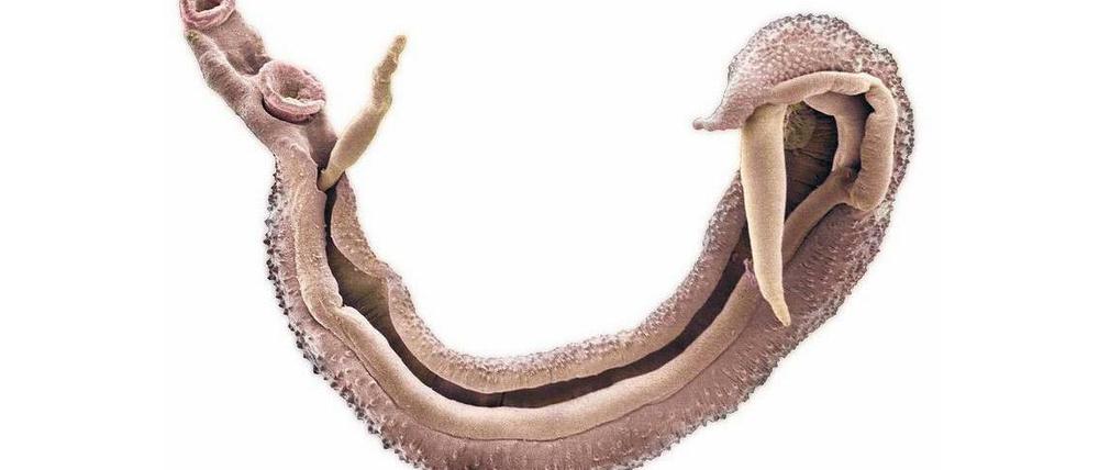 Ein Pärchen Pärchen-Egel. Das Männchen bildet eine Rinne, in die sich das längere, dünnere Weibchen verkriecht. In dieser Form können die Parasiten Jahrzehnte im Blut des Menschen überdauern.