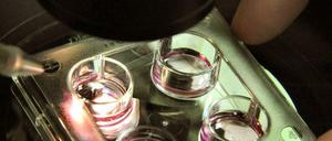 Untersuchung von Eizellen im Kinderwunschzentrum Leipzig.