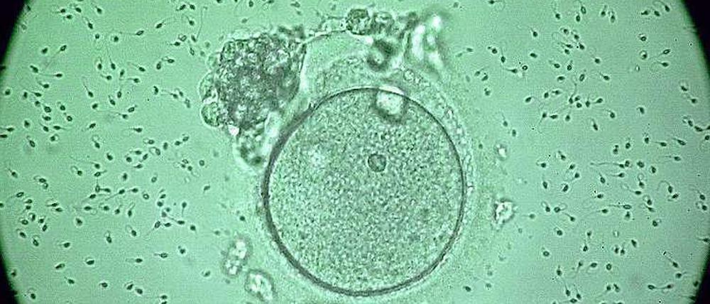 Die Tochter eines anonymen Samenspenders hat am Oberlandesgericht Hamm (OLG) das Recht auf die Herausgabe des Namens ihres biologischen Vaters erreicht.