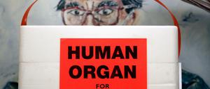 Eine Kühlbox für Spenderorgane: Wegen Manipulationsverdacht sitzt ein früherer Oberarzt jetzt in Untersuchungshaft.