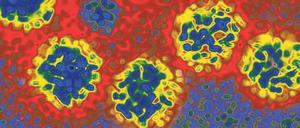 Tückisch. Das Hepatitis-C-Virus ist so wandelbar, dass man mehrere Medikamente braucht, um es loszuwerden.