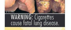 Ab Herbst 2012 werden Zigarettenschachteln in den USA mit Schockfotos bedruckt.
