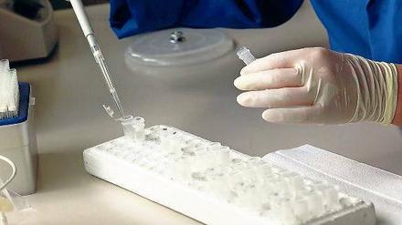 Mit Präzision. Um Krankheiten zu behandeln, müssen Mediziner zunächst verstehen, was genau im menschlichen Körper passiert. Dabei helfen umfassende Laboranalysen. 