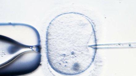 Leben aus dem Labor. Die künstliche Befruchtung ermöglicht es, schwere Erbkrankheiten bereits bei einem Embryo zu erkennen, der nur aus wenigen Zellen besteht. Nach einem entsprechenden Gentest werden nur gesunde Embyronen eingepflanzt.
