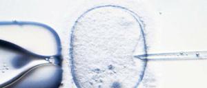 Leben aus dem Labor. Die künstliche Befruchtung ermöglicht es, schwere Erbkrankheiten bereits bei einem Embryo zu erkennen, der nur aus wenigen Zellen besteht. Nach einem entsprechenden Gentest werden nur gesunde Embyronen eingepflanzt.