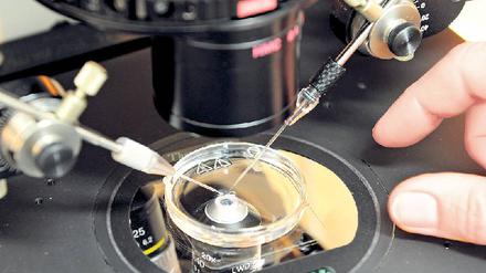 Moderne Zeugung. Bei der künstlichen Befruchtung wird ein Spermium unter dem Mikroskop in eine Eizelle injiziert. In diesen Embryonen könnten Forscher vor der Einpflanzung in den Mutterleib nach schweren Erkrankungen suchen, falls der Gesetzgeber das zulässt. Foto: dpa