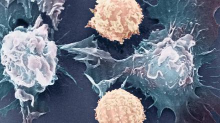 Entfesselt. Das ungehemmte Wachstum von Krebszellen beruht nicht nur auf genetischen Mutationen. Entscheidend ist auch, ob Gene an- oder abgeschaltet sind.