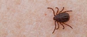 Zecken übertragen Borrelien-Bakterien.