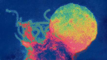 Masern-Virus. Bis 2015 sollten die Masern in Deutschland ausgerottet sein. Davon ist die Bundesrepublik derzeit weit entfernt.