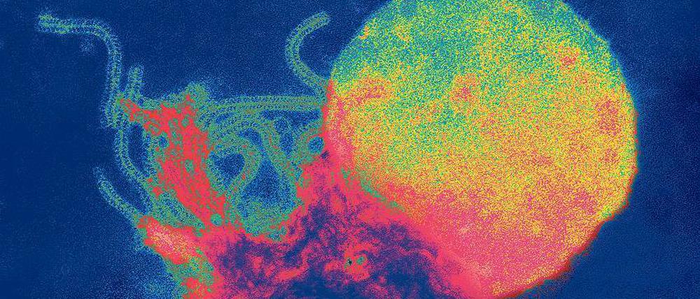 Masern-Virus. Bis 2015 sollten die Masern in Deutschland ausgerottet sein. Davon ist die Bundesrepublik derzeit weit entfernt.