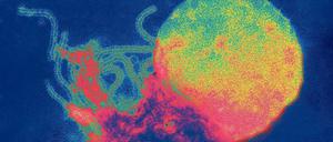 Masern-Virus. Bis 2015 sollten die Masern in Deutschland ausgerottet sein. Davon ist die Bundesrepublik derzeit weit entfernt.
