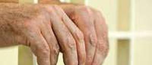 Die Sicherungsverwahrung verstößt gegen die Menschenrechte hat der Europäische Gerichtshof entschieden. Mehrere Gewaltverbrecher mussten daraufhin entlassen werden.