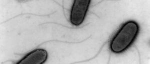 Mittels eines Elektronenmikroskops erstelltes Foto von EHEC-Bakterien. Archiv