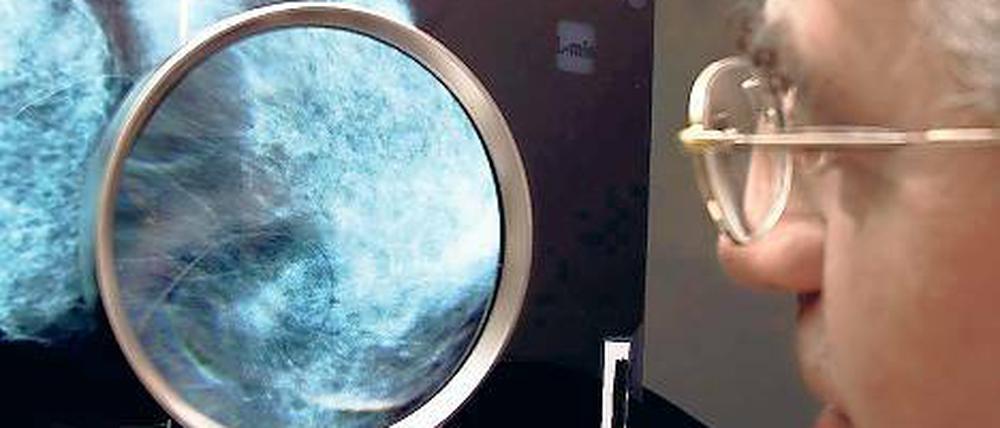 Dignaose Brustkrebs. Eine neue Selbsthilfegruppe richtet sich an Betroffene, die in der Mitte ihres Lebens stehen.