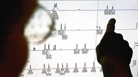 Ein Fall für zwei. Rechtsmediziner analysierten DNA-Material vom Tatort, es gehört eindeutig einem der beiden verdächtigen Brüder. Doch da sie eineiige Zwillinge sind, ist der Fall möglichweise nicht aufzuklären.