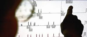 Ein Fall für zwei. Rechtsmediziner analysierten DNA-Material vom Tatort, es gehört eindeutig einem der beiden verdächtigen Brüder. Doch da sie eineiige Zwillinge sind, ist der Fall möglichweise nicht aufzuklären.