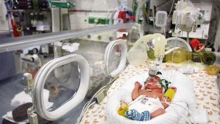 Intensivbehandlung. Im Virchow-Klinikum tun Ärzte und Schwestern mit Hilfe der Medizintechnik alles dafür, Frühchen wie diesem Jungen das Überleben zu ermöglichen.
