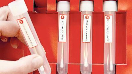 Maßgeschneidert. Der Abgleich von Patientendaten kann die Therapie entscheidend optimieren.