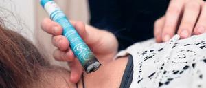 In der „Etage3“ in der Zeppelinstraße arbeiten mehrere Therapeuten. Hier wird zum Beispiel eine Moxibustion angewendet – eine Wärmetherapie aus der Traditionellen Chinesischen Medizin. 