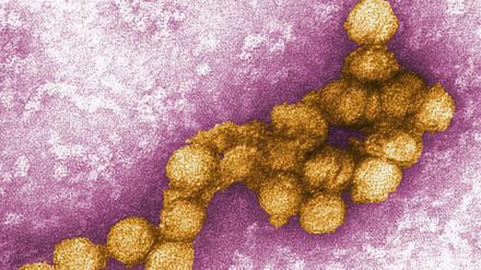 Das West-Nil-Virus.