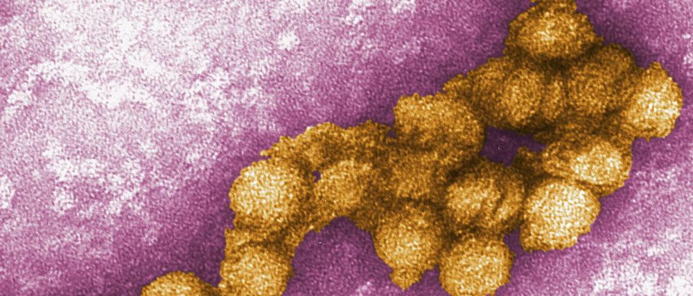 Das West-Nil-Virus.
