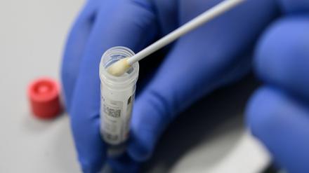 Coronatest. Aus Abstrichen besteht das Testverfahren auf das Virus.