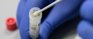 Coronatest. Aus Abstrichen besteht das Testverfahren auf das Virus.