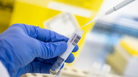 Die Zahl der Verdachtsfälle und Infizierten steigt im Landkreis weiterhin an, dafür sind weniger Menschen in Quarantäne.  