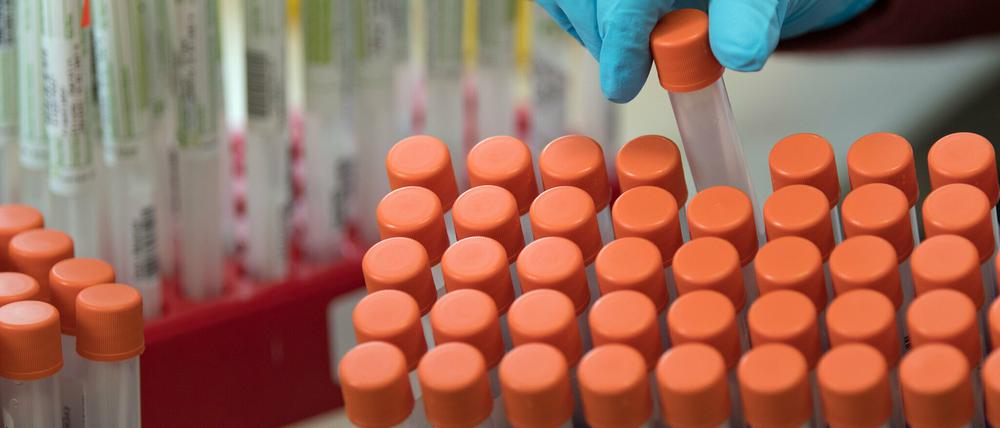 Die Zahl der Verdachtsfälle im Kreis steigt von 1777 auf 1918 an. 379 Personen sind nachweislich infiziert.